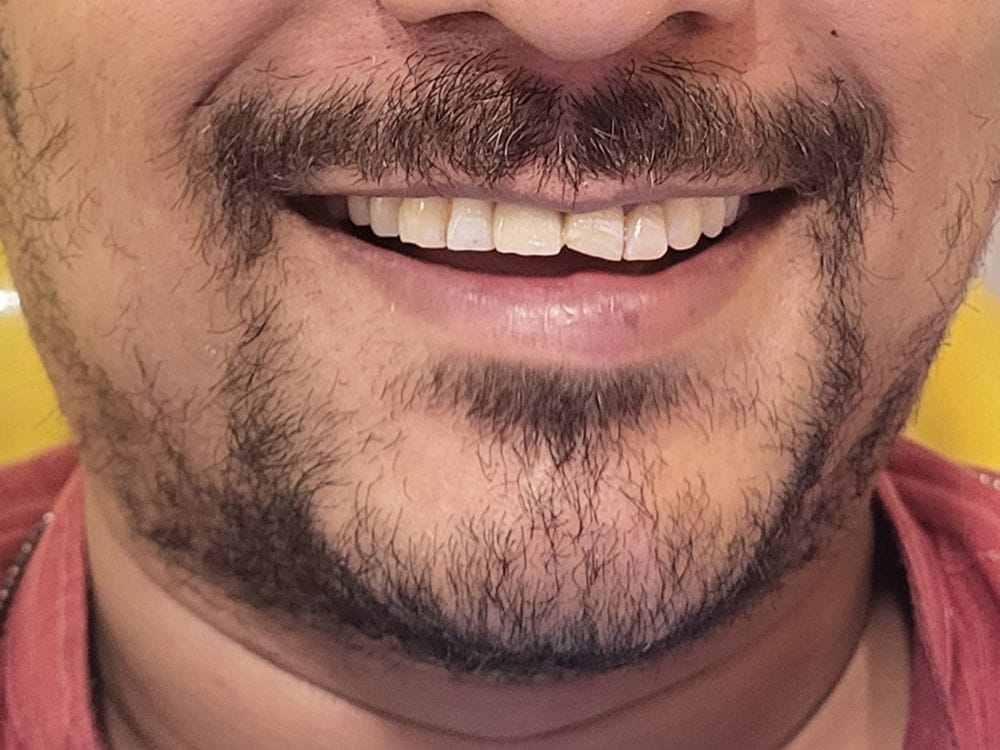 After